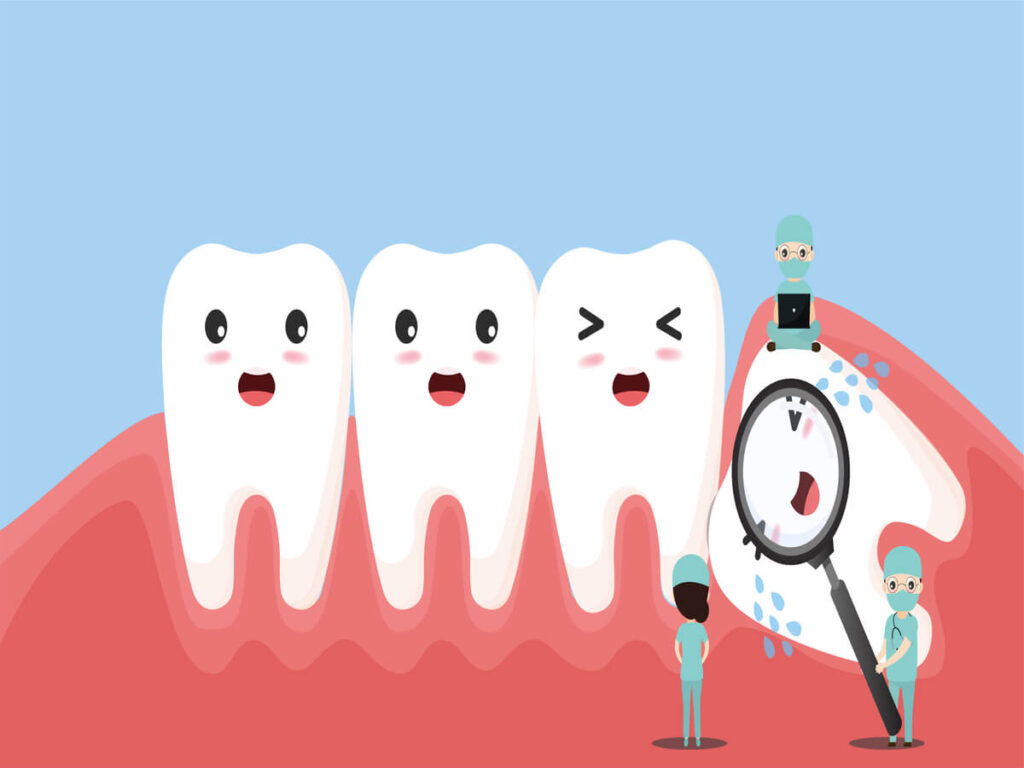 dentists are caring painful impacted wisdom tooth