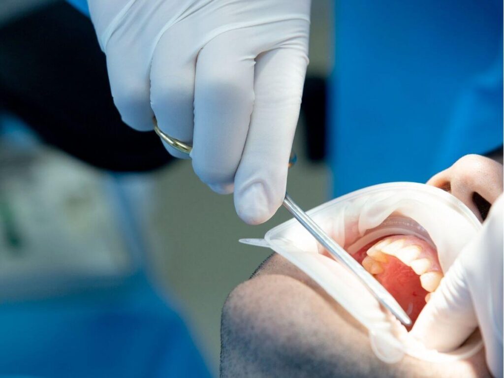 dental surgery in one of the best dental clinics