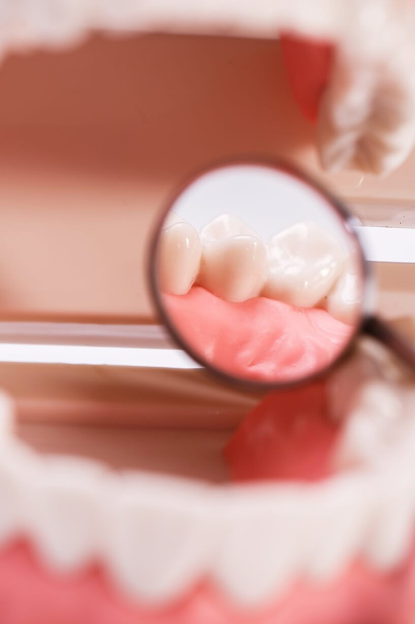 denture teeth